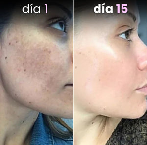REPARA, REGENERA Y PROTEGE TU Y PIEL CON SANGRE DE DRAGÓN  INFIBELLA
